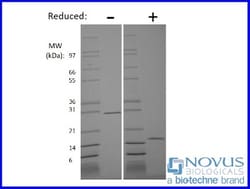 Novus Biologicals™ Recombinant Human GDNF Animal-Free Protein